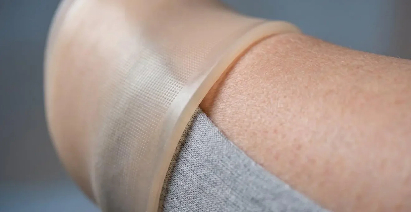 Close-up detailed view of prosthetic socket interface showing fit assessment and limb contact surface